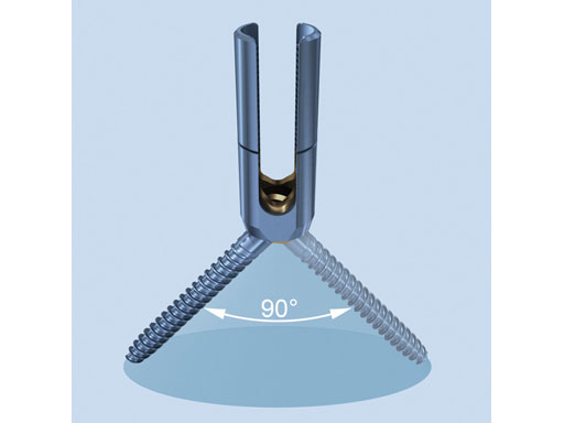 UniversalReductionScrewsTreatmentDeformities_3