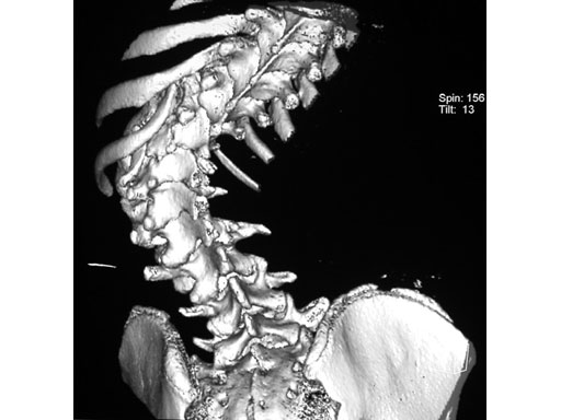 UniversalReductionScrewsTreatmentDeformities_5