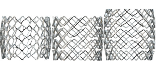 VertebralBodyStent_2