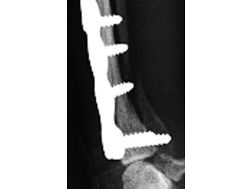 VETLCPNotchedHeadT-Plate_4