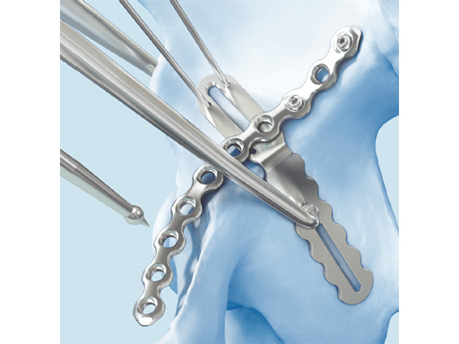 22-3-5-Quadrilateral-Surface-03