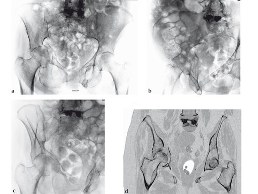 22-3-5-Quadrilateral-Surface-05