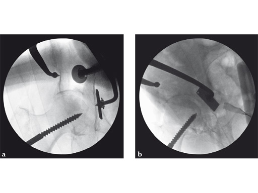 22-3-5-Quadrilateral-Surface-06