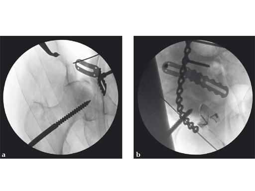 22-3-5-Quadrilateral-Surface-07