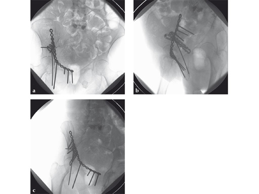 22-3-5-Quadrilateral-Surface-08