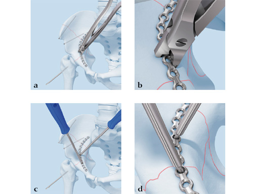 26-In-Situ-Bending-Instruments-03
