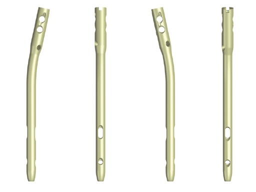 29-Hindfoot-Arthrodesis-Nail-HAN-02