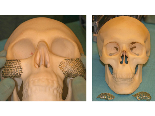 34-sterile-artificial-skull-03