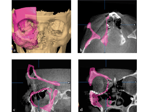 34-sterile-artificial-skull-07