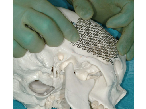 34-sterile-artificial-skull-08