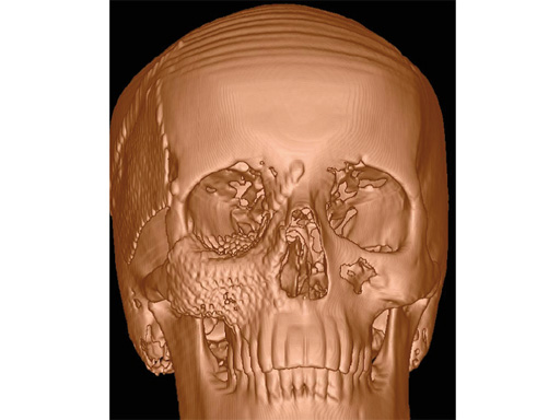 34-sterile-artificial-skull-09
