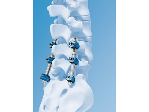 49-NF-lex-Stabilization-System-01