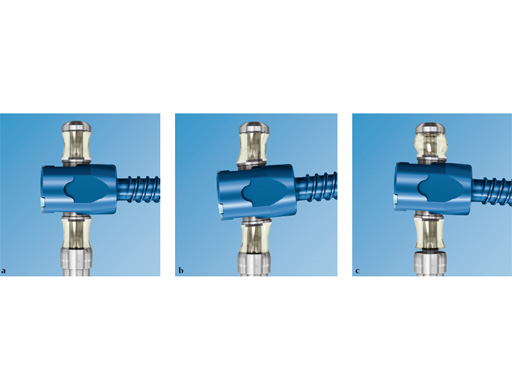 49-NF-lex-Stabilization-System-02