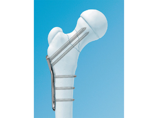 LCP-PHP-130-3_5-5_0-01