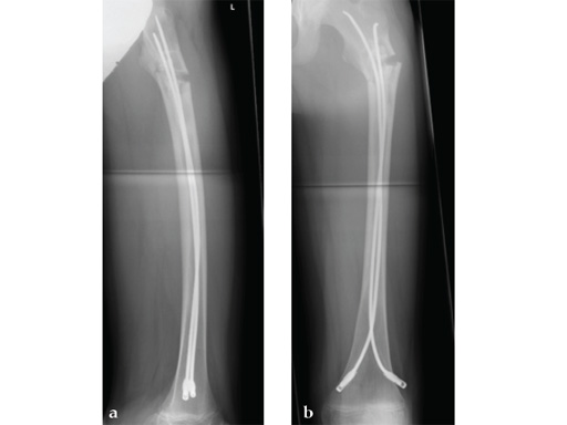 LCP-PHP-130-3_5-5_0-03