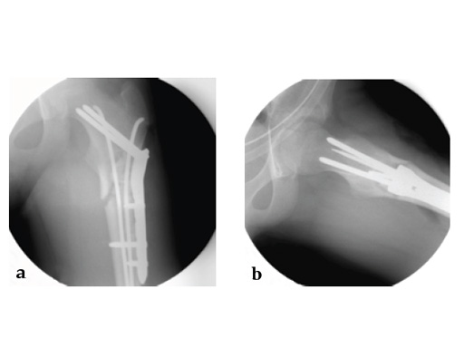 LCP-PHP-130-3_5-5_0-04