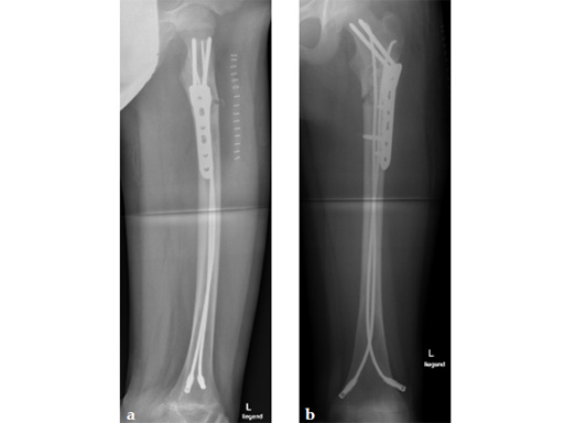 LCP-PHP-130-3_5-5_0-05