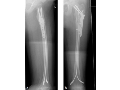 LCP-PHP-130-3_5-5_0-06