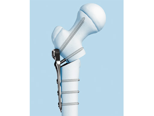 LCP-PHP-140-3_5-5_0-01