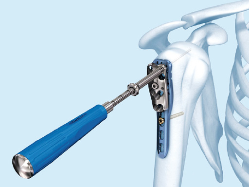 PHILOS-Instrument-Upgrade-01