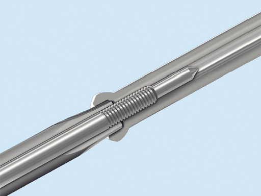 SCFE-Screw-System-04