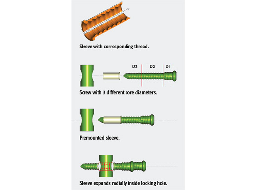 Tips-Tricks-ASLS-IM-Nails-01