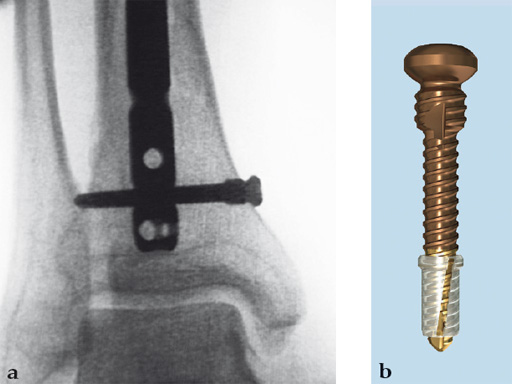 Tips-Tricks-ASLS-IM-Nails-02