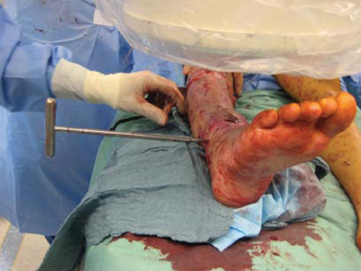 Tips-Tricks-ASLS-IM-Nails-03