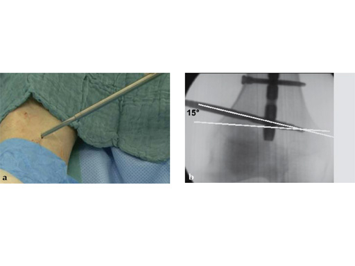 Tips-Tricks-ASLS-IM-Nails-04