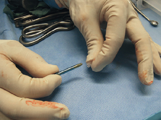 Tips-Tricks-ASLS-IM-Nails-05