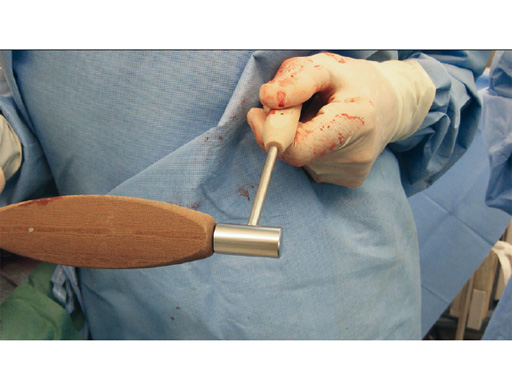 Tips-Tricks-ASLS-IM-Nails-08