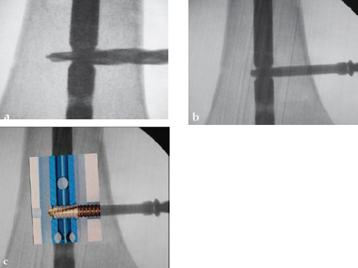 Tips-Tricks-ASLS-IM-Nails-09