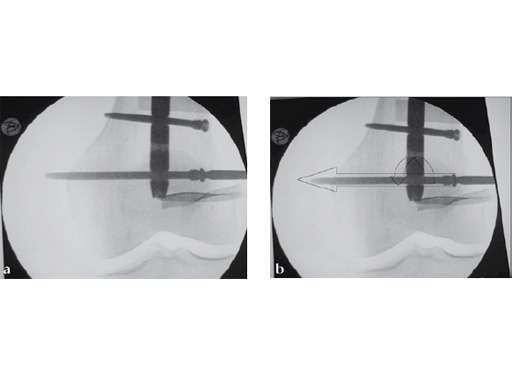 Tips-Tricks-ASLS-IM-Nails-10