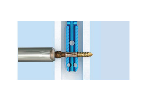 Tips-Tricks-ASLS-IM-Nails-11