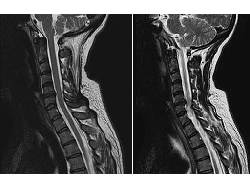 cervicobrachial Fig 1a-b