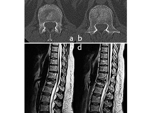 uss-fractures-case-c