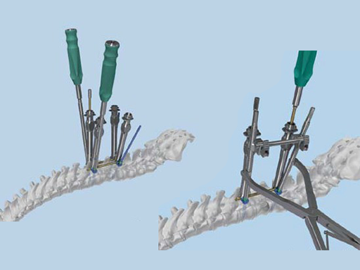 uss-fractures-case-d