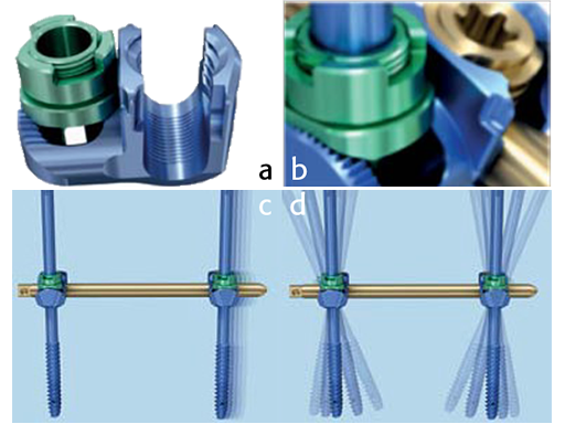 uss-fractures-clamp