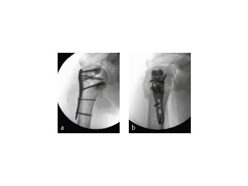 06-PHILOS-Augmented-Fig-6_web