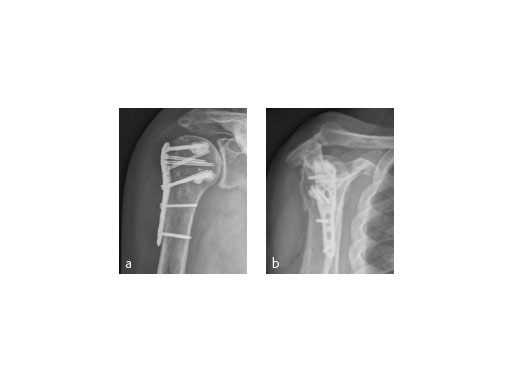 07-PHILOS-Augmented-Fig-7_web