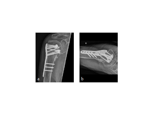 09-PHILOS-Augmented-Fig-9_web
