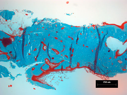 LockReconMiniPlate_fig7