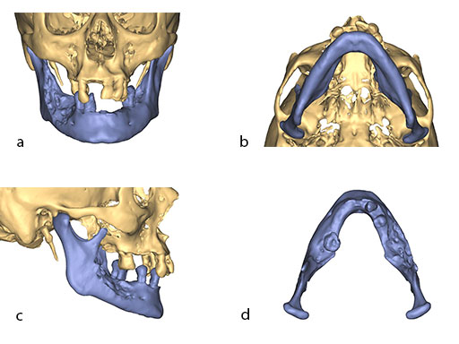 psmp-fig3