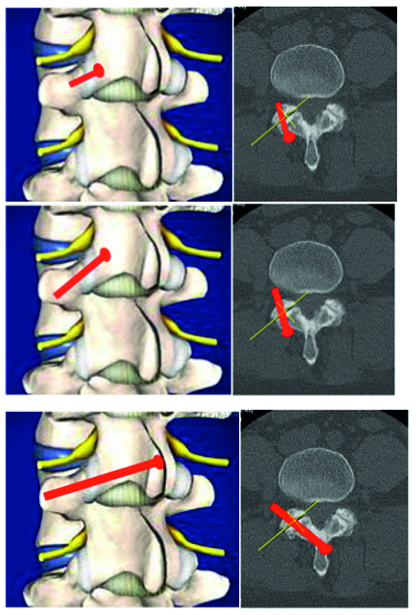 FacetwedgeFig_1ab2ab3ab