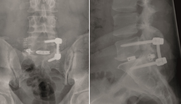 KandzioraCase1_Fig8ab
