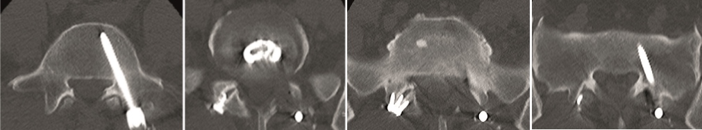 KandzioraCase1_Fig9abcd