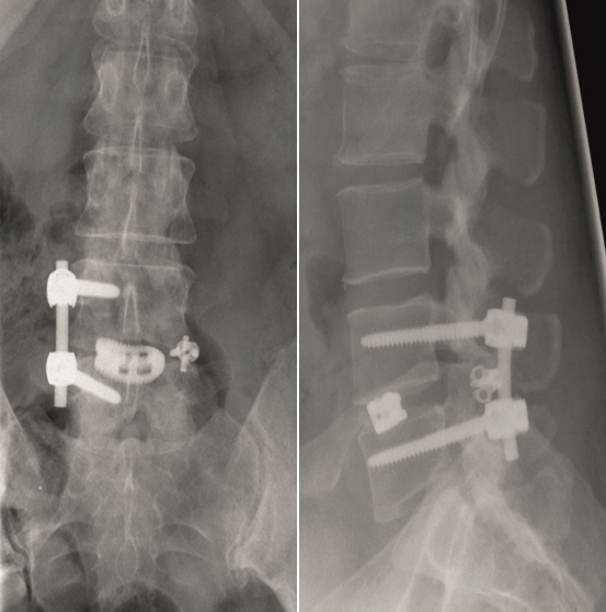 KandzioraCase2_Fig12ab