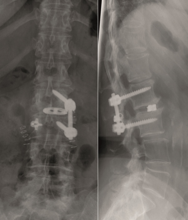 KandzioraCase3_Fig14ab