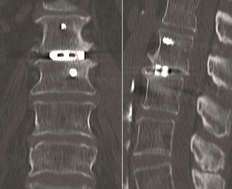 KandzioraCase3_Fig15ab