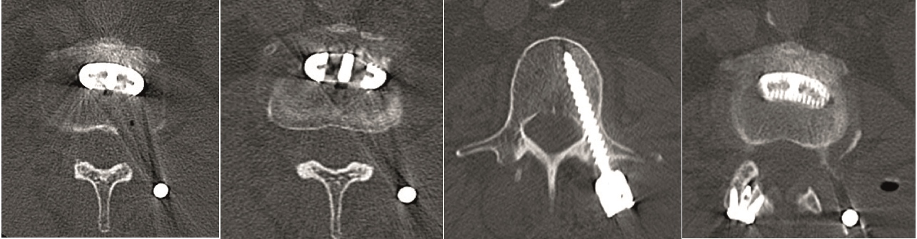 KandzioraCase3_Fig16ae